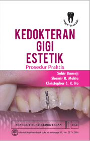 Kedokteran Gigi Estetik: Prosedur Praktis