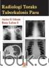 Radiologi Toraks Tuberkulosis Paru