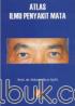 Atlas Ilmu Penyakit Mata