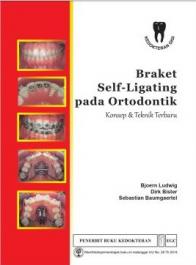 Braket Self-Ligating pada Ortodontik: Konsep & Teknik Terbaru
