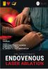 Buku Panduan Praktis Endovenous Laser Ablation