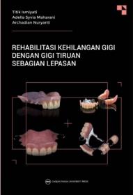 Rehabilitasi Kehilangan Gigi dengan Gigi Tiruan Sebagian Lepasan