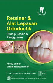Retainer dan Alat Lepasan Ortodontik: Prinsip Desain dan Penggunaan