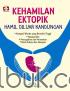 Kehamilan Ektopik: Hamil di Luar Kandungan