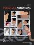 Psikologi Abnormal (Edisi 17)